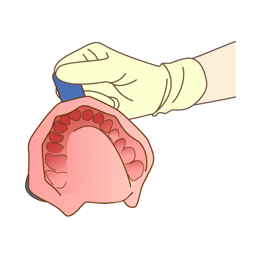 歯医者の型どりが苦手!どのように対処する?