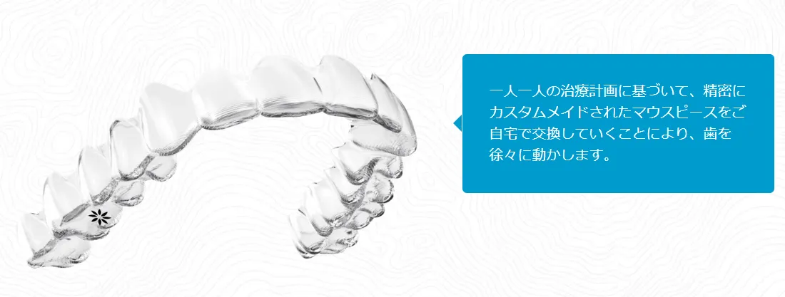 マウスピース矯正は誰でも出来る??