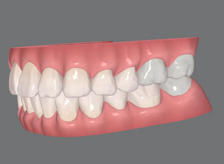 歯と歯茎と骨の関係